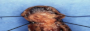 leechplus